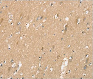 Immunohistochemistry (Formalin/PFA-fixed paraffin-embedded sections) - Anti-SIGLEC10 antibody - C-terminal (AB198724)