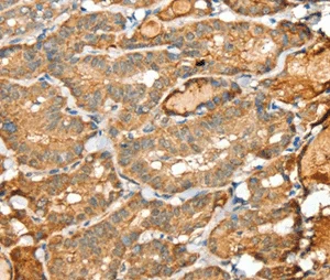 Immunohistochemistry (Formalin/PFA-fixed paraffin-embedded sections) - Anti-SIGLEC14 antibody (AB198732)
