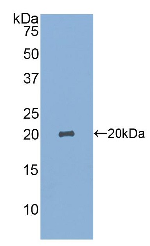 Western blot - Anti-SIGLEC14 antibody (AB233299), expandable thumbnail