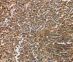 Immunohistochemistry (Formalin/PFA-fixed paraffin-embedded sections) - Anti-SIGLEC15 antibody (AB198684)