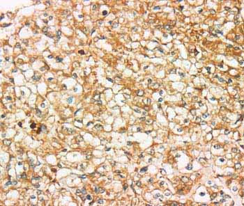 Immunohistochemistry (Formalin/PFA-fixed paraffin-embedded sections) - Anti-SIGLEC15 antibody (AB198684)