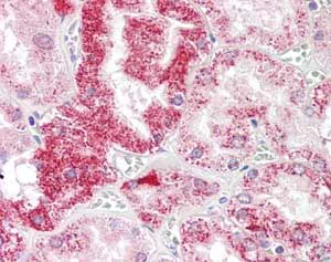 Immunohistochemistry (Formalin/PFA-fixed paraffin-embedded sections) - Anti-SIGLEC15 antibody - N-terminal (AB174732)