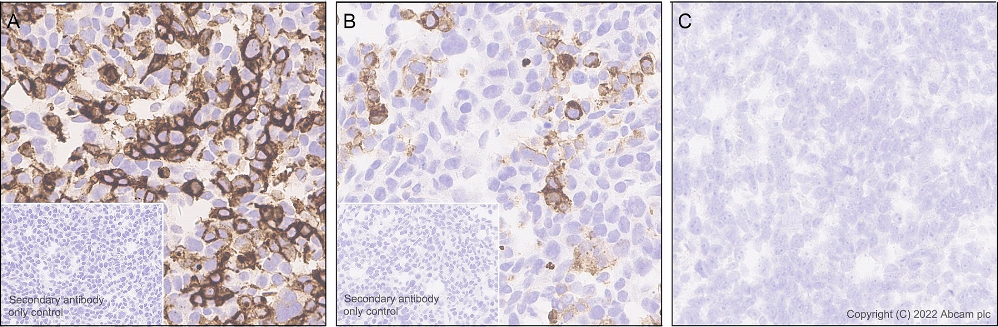 Immunohistochemistry (Formalin/PFA-fixed paraffin-embedded sections) - Anti-SIGLEC5 antibody [EPR26250-156] (AB307434), expandable thumbnail