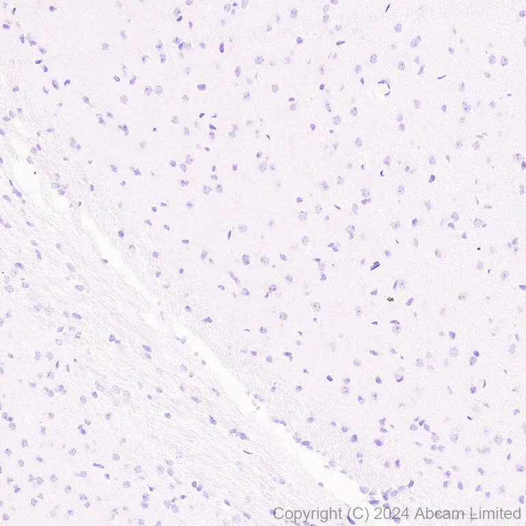 Immunohistochemistry (Formalin/PFA-fixed paraffin-embedded sections) - Anti-SIGLEC5 antibody [EPR29501-522] - BSA and Azide free (AB320089)