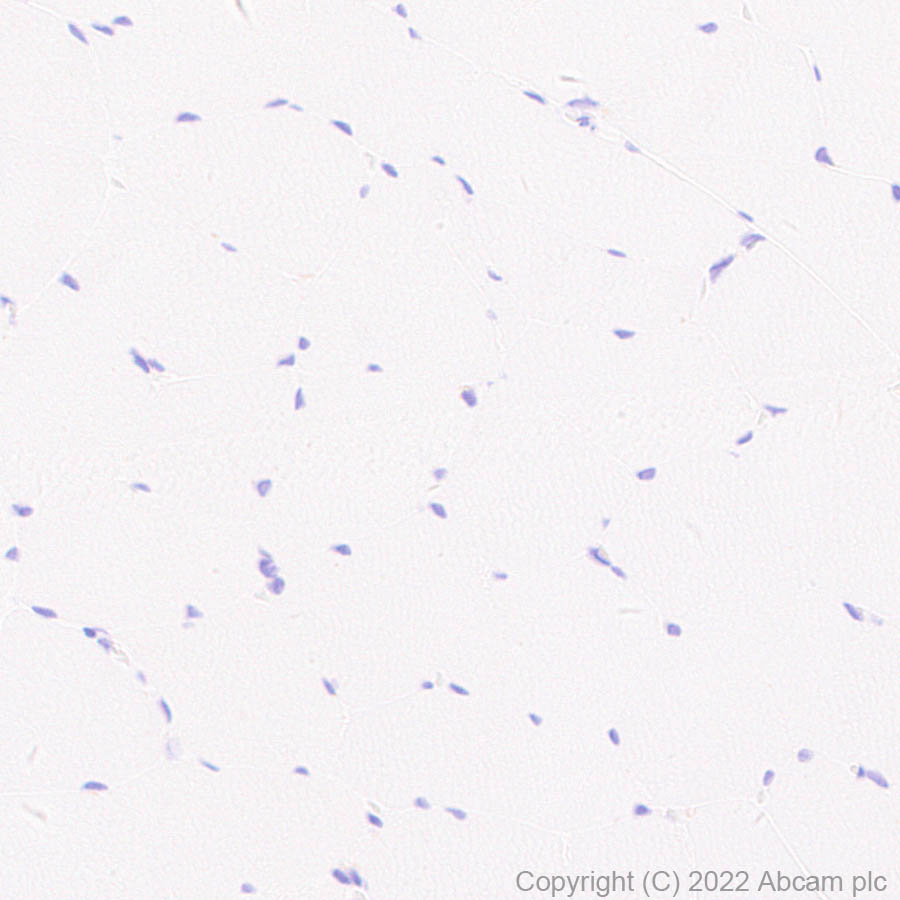 Immunohistochemistry (Formalin/PFA-fixed paraffin-embedded sections) - Anti-SIGLEC5 antibody [RM2001] (ab307846), expandable thumbnail