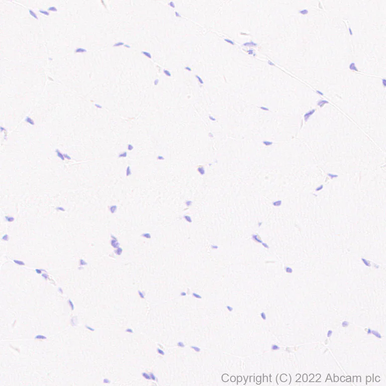 Immunohistochemistry (Formalin/PFA-fixed paraffin-embedded sections) - Anti-SIGLEC5 antibody [RM2001] - BSA and Azide free (AB307847)