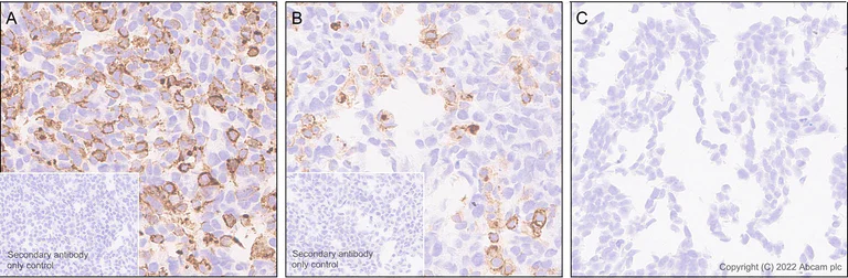 Immunohistochemistry (Formalin/PFA-fixed paraffin-embedded sections) - Anti-SIGLEC5 antibody [RM2001] - BSA and Azide free (AB307847)