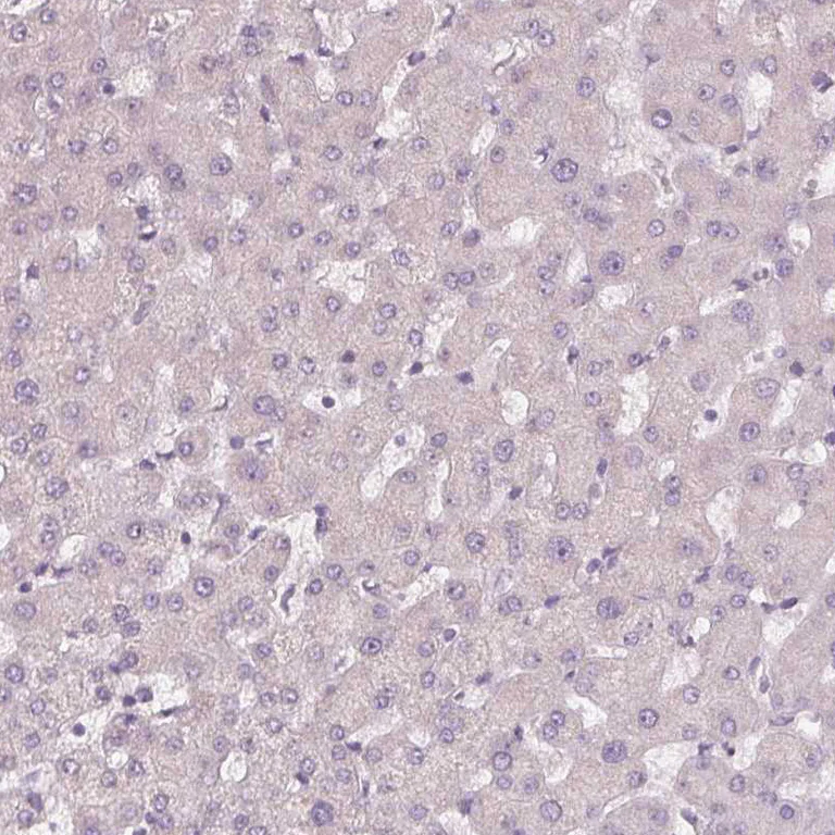 Immunohistochemistry (Formalin/PFA-fixed paraffin-embedded sections) - Anti-SIGLEC6 antibody (AB224406)