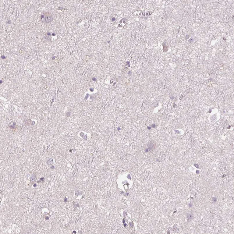 Immunohistochemistry (Formalin/PFA-fixed paraffin-embedded sections) - Anti-SIGLEC6 antibody (AB224406)