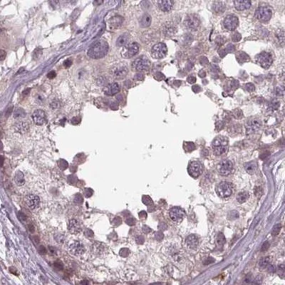Immunohistochemistry (Formalin/PFA-fixed paraffin-embedded sections) - Anti-SIGLEC6 antibody (AB262851)