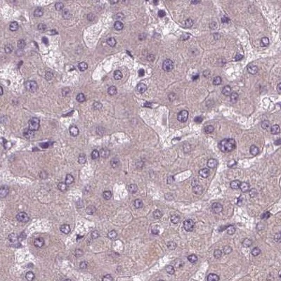 Immunohistochemistry (Formalin/PFA-fixed paraffin-embedded sections) - Anti-SIGLEC6 antibody (AB262851)