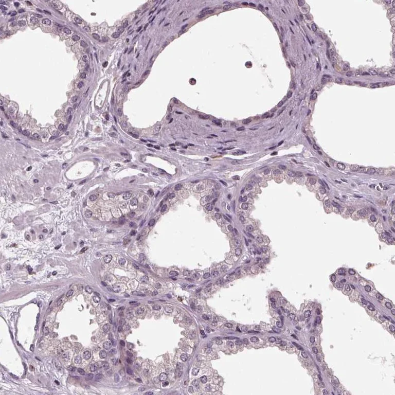 Immunohistochemistry (Formalin/PFA-fixed paraffin-embedded sections) - Anti-SIGLEC6 antibody (AB262851)
