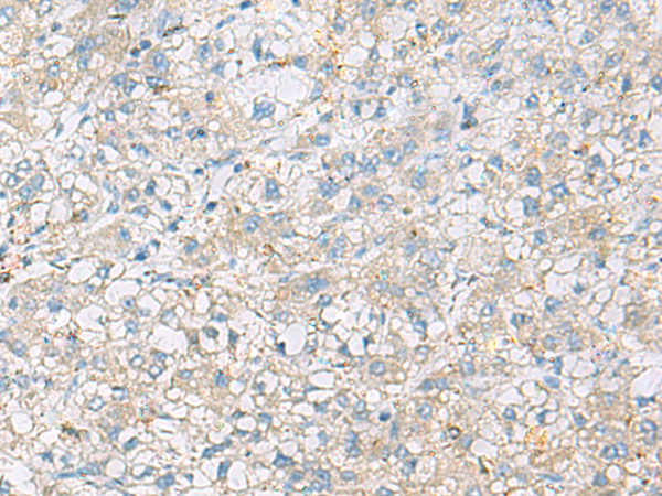 Immunohistochemistry (Formalin/PFA-fixed paraffin-embedded sections) - Anti-SIGLEC8 antibody - C-terminal (AB198690)