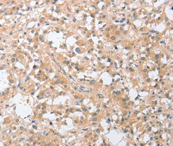 Immunohistochemistry (Formalin/PFA-fixed paraffin-embedded sections) - Anti-SIGLEC9 antibody (AB197981)