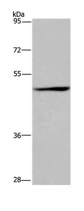 Western blot - Anti-SIGLEC9 antibody (AB197981)