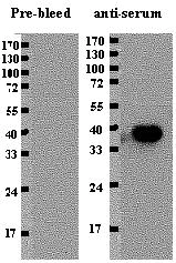 Western blot - Anti-Sigma 32 antibody (AB26890)