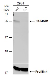Western blot - Anti-Sigma1-receptor antibody (AB151288), expandable thumbnail