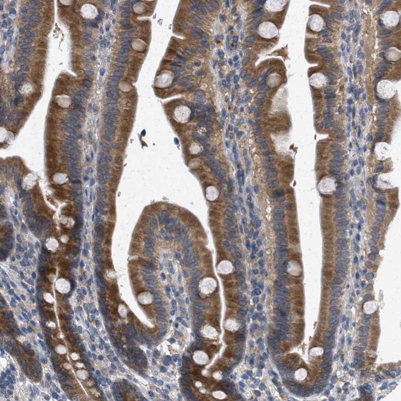 Immunohistochemistry (Formalin/PFA-fixed paraffin-embedded sections) - Anti-Sigma1-receptor antibody (AB223702), expandable thumbnail