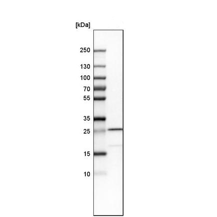 Western blot - Anti-Sigma1-receptor antibody (ab223702), expandable thumbnail