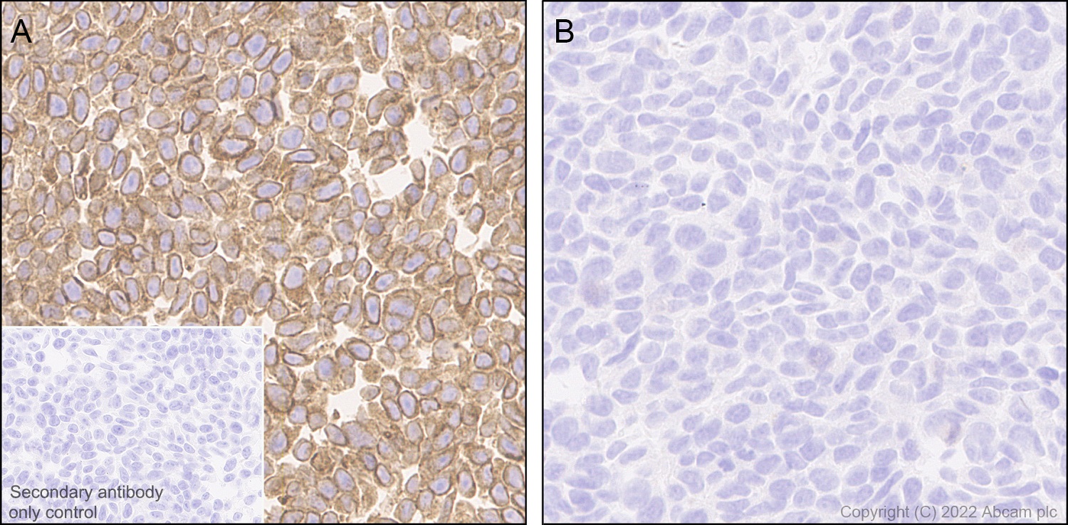 Immunohistochemistry (Formalin/PFA-fixed paraffin-embedded sections) - Anti-Sigma1-receptor antibody [EPR25145-11] - BSA and Azide free (ab307549), expandable thumbnail