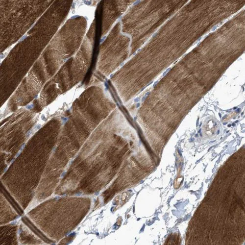 Immunohistochemistry (Formalin/PFA-fixed paraffin-embedded sections) - Anti-SIK2 antibody (AB244350)