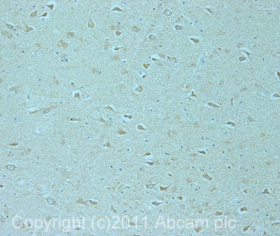 Immunohistochemistry (Formalin/PFA-fixed paraffin-embedded sections) - Anti-SIK2 antibody (AB53423)