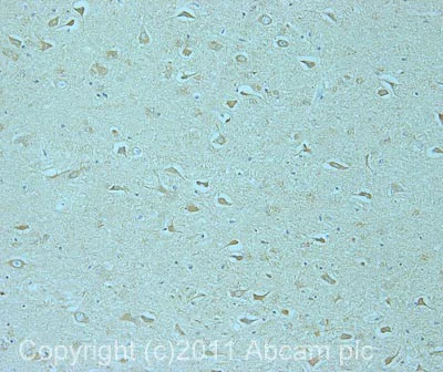 Immunohistochemistry (Formalin/PFA-fixed paraffin-embedded sections) - Anti-SIK2 antibody (AB53423)