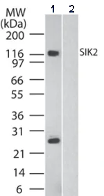 Western blot - Anti-SIK2 antibody (AB53423)