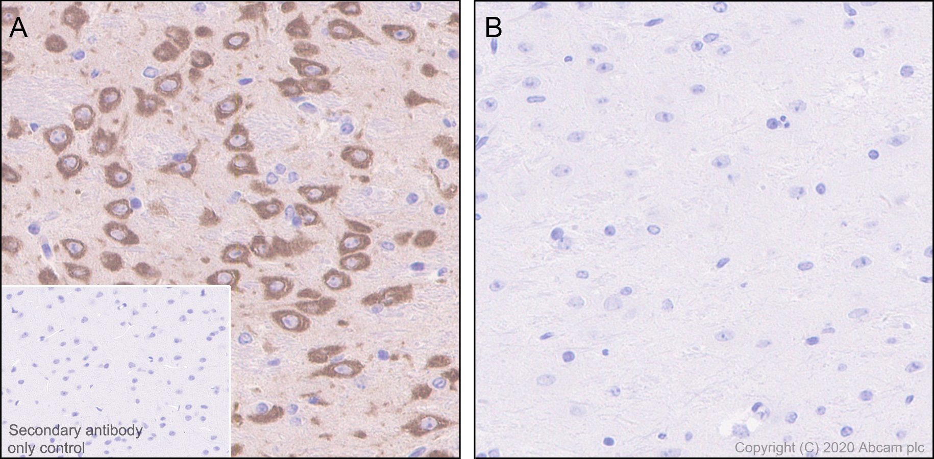 Immunohistochemistry (Formalin/PFA-fixed paraffin-embedded sections) - Anti-SIK3 (phospho S551) antibody [EPR20878-12] - BSA and Azide free (AB283510), expandable thumbnail