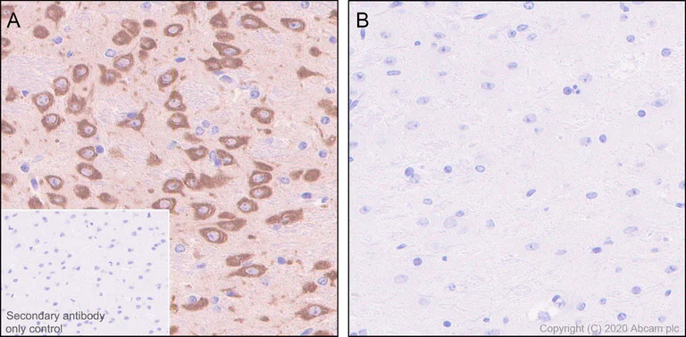 Immunohistochemistry (Formalin/PFA-fixed paraffin-embedded sections) - Anti-SIK3 (phospho S551) antibody [EPR20878-12] - BSA and Azide free (AB283510)