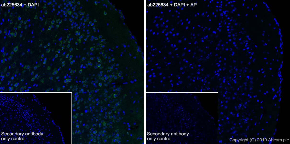 Immunohistochemistry (Frozen sections) - Anti-SIK3 (phospho S551) antibody [EPR20878-12] - BSA and Azide free (AB283510), expandable thumbnail