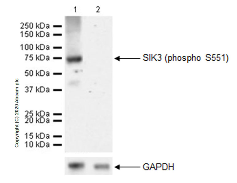 Western blot - Anti-SIK3 (phospho S551) antibody [EPR20878-12] - BSA and Azide free (AB283510), expandable thumbnail