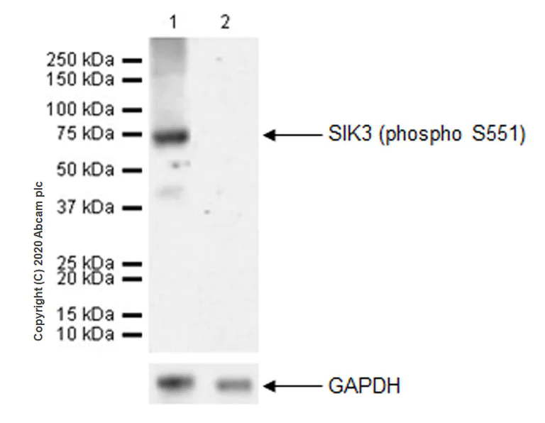 Western blot - Anti-SIK3 (phospho S551) antibody [EPR20878-12] - BSA and Azide free (AB283510)