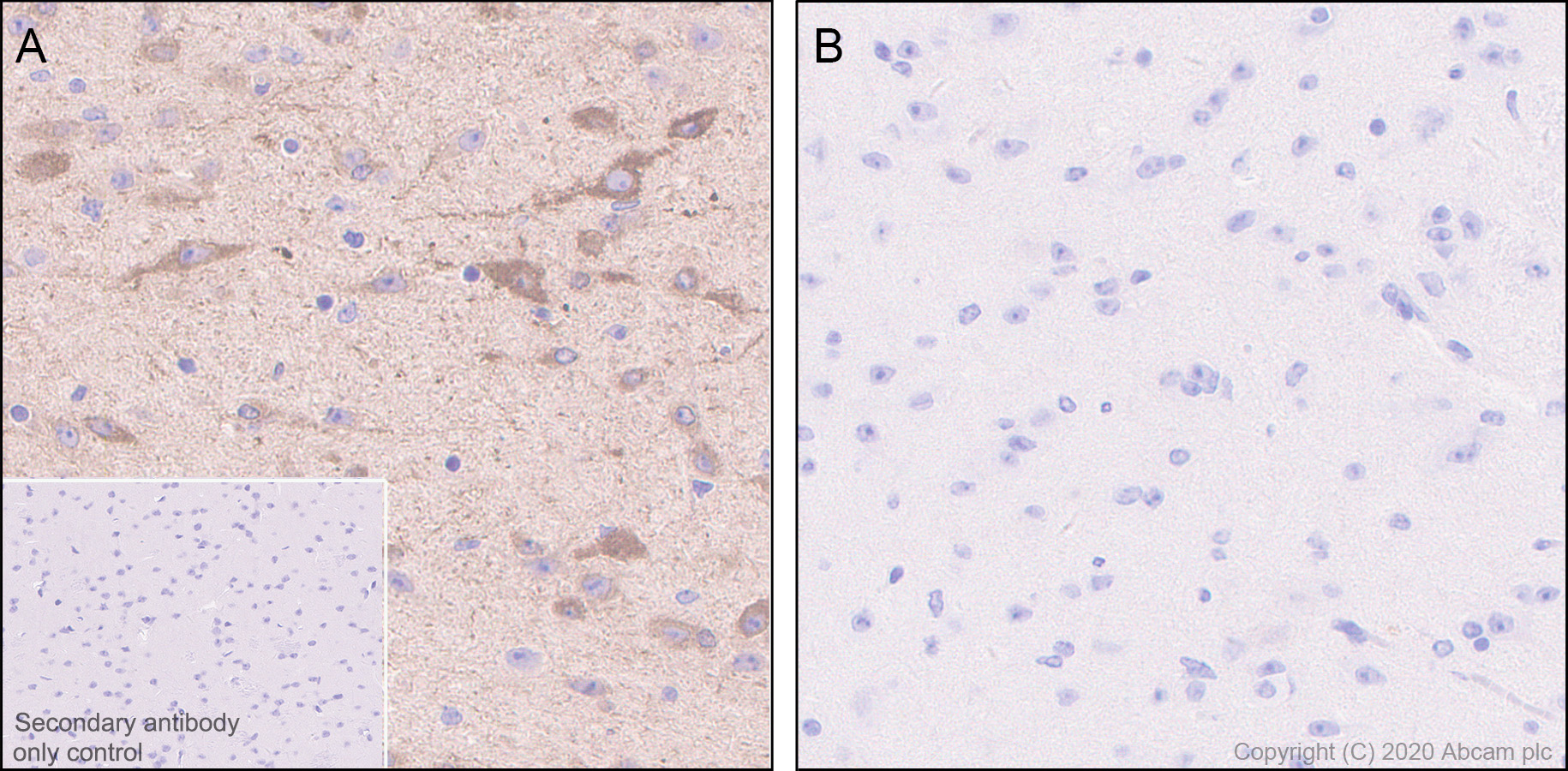 Immunohistochemistry (Formalin/PFA-fixed paraffin-embedded sections) - Anti-SIK3 (phospho T469) antibody [EPR20877-104] (AB225633), expandable thumbnail