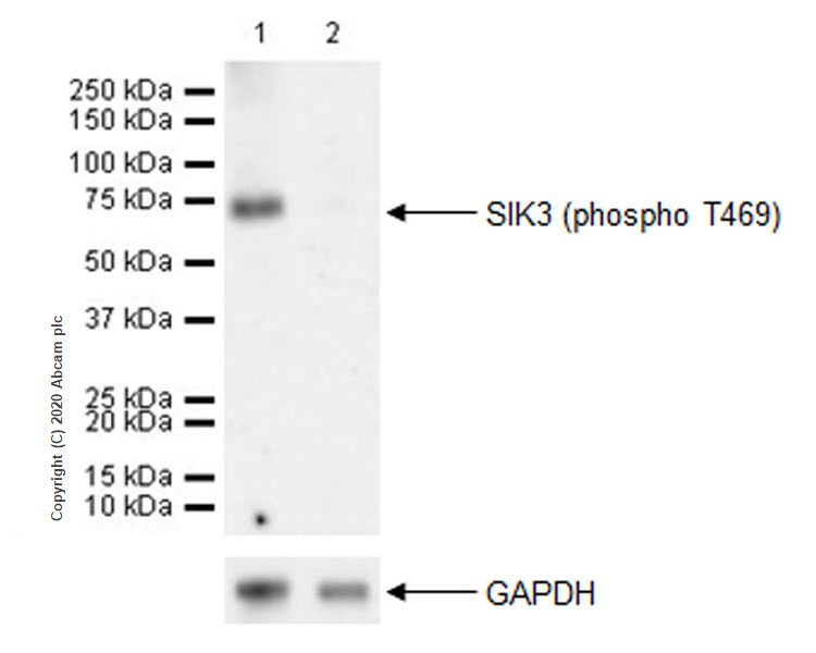 Western blot - Anti-SIK3 (phospho T469) antibody [EPR20877-104] (AB225633), expandable thumbnail