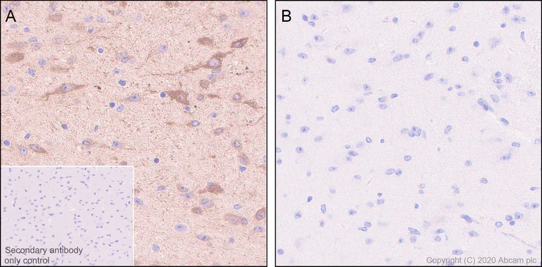 Immunohistochemistry (Formalin/PFA-fixed paraffin-embedded sections) - Anti-SIK3 (phospho T469) antibody [EPR20877-104] - BSA and Azide free (AB283509)