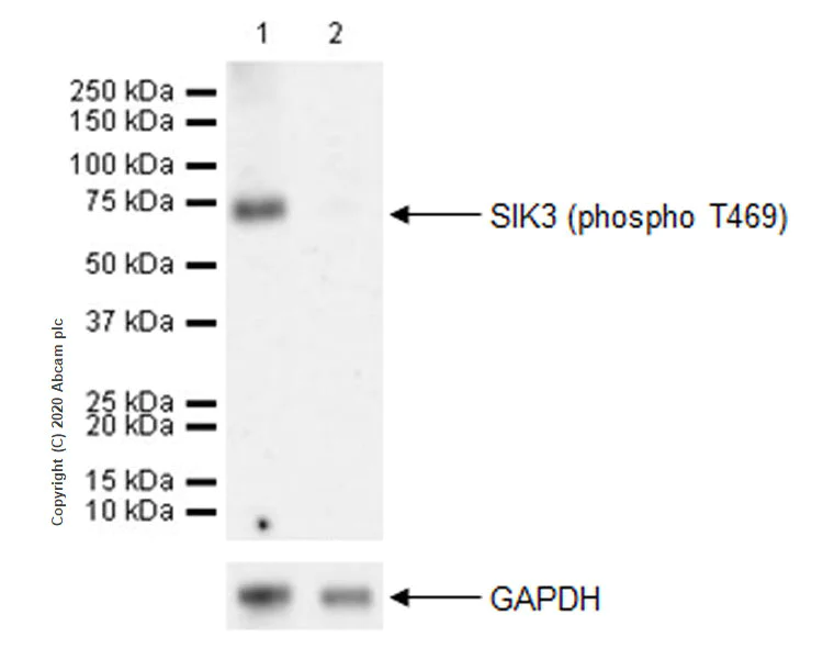 Western blot - Anti-SIK3 (phospho T469) antibody [EPR20877-104] - BSA and Azide free (AB283509)