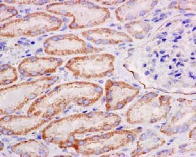 Immunohistochemistry (Formalin/PFA-fixed paraffin-embedded sections) - Anti-SIKE1 antibody [EPR14692] (AB183509)