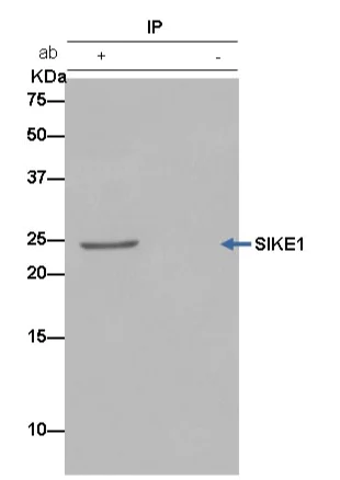 Immunoprecipitation - Anti-SIKE1 antibody [EPR14692] (AB183509)