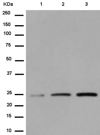 Western blot - Anti-SIKE1 antibody [EPR14692] (AB183509)