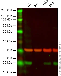 Western blot - Anti-SIKE1 antibody [EPR14692] (AB183509)