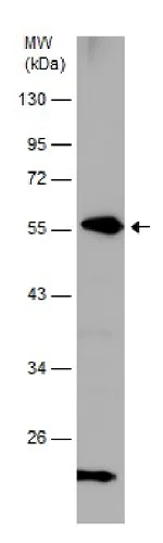 Western blot - Anti-SIL1 antibody (AB228844)