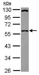 Western blot - Anti-SIL1 antibody (AB228868), expandable thumbnail