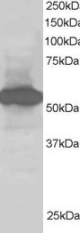 Western blot - Anti-SIL1 antibody (AB5639)