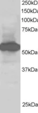 Western blot - Anti-SIL1 antibody (AB5639)