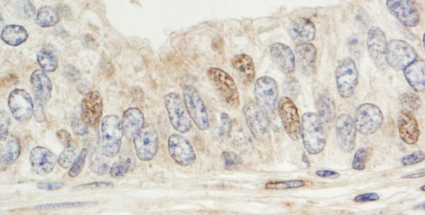 Immunohistochemistry (Formalin/PFA-fixed paraffin-embedded sections) - Anti-SIN1 antibody (AB71152)