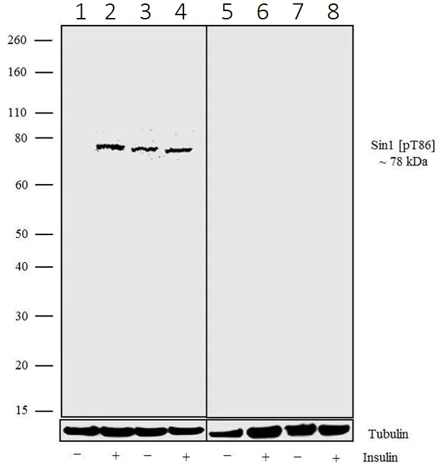 Western blot - Anti-SIN1 (phospho T86) antibody [19HCLC] (AB277787)