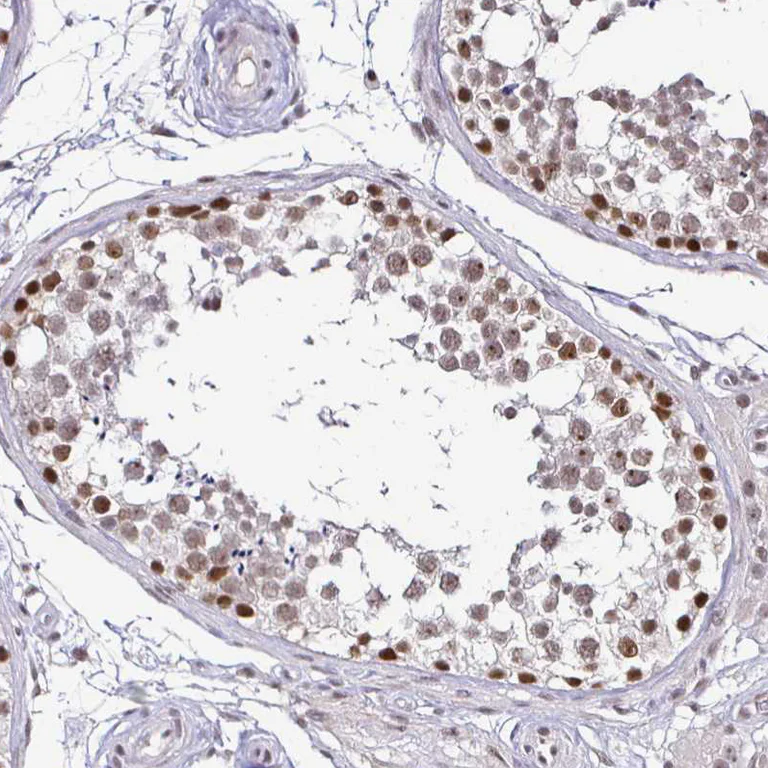 Immunohistochemistry (Formalin/PFA-fixed paraffin-embedded sections) - Anti-SIN3A Antibody (AB327253)
