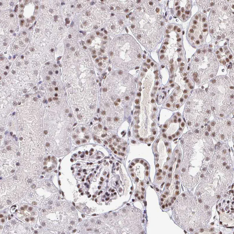 Immunohistochemistry (Formalin/PFA-fixed paraffin-embedded sections) - Anti-SIN3A Antibody (AB327253)