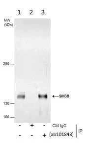 Immunoprecipitation - Anti-Sin3b antibody (AB101843)